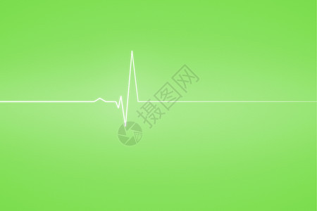 具有绿如线的医疗背景波形绿色电极计算机监视器绘图心电图图片