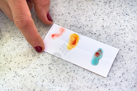 血型测试卡片科学抗原手术卫生健康医院考试样本志愿者图片