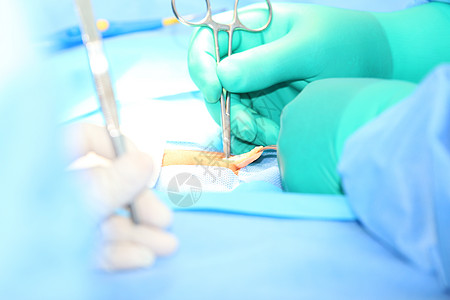 开放性心血管外科手术图片