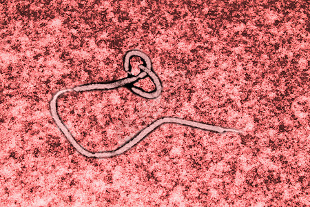 埃博拉病毒风险病原疫苗警告药品细菌微生物学需氧感染生物学背景图片