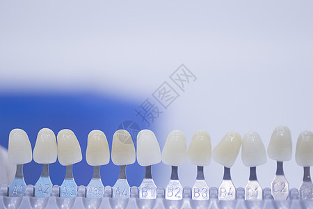 植入和皇冠颜色牙齿牙牙色指南医疗办公室保健卫生用品人类手术药品蓝色白色图片