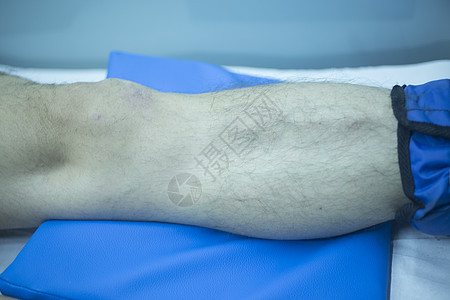 理疗中受伤男子腿部锻炼治疗扭伤医疗诊所人体保健物理关节医学图片