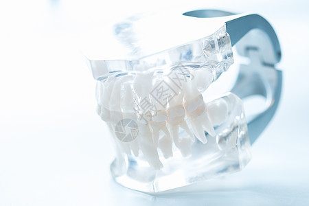 牙科模型牙龈假牙支撑磨牙犬类医生金属治疗口腔科矫正图片