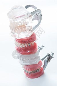 牙科模型治疗犬类矫正假牙诊所牙龈牙齿金属支撑医生图片