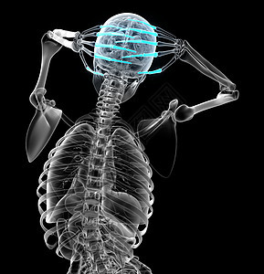 3d 表示人体长颈手的插图风湿病手腕手臂方阵指骨骨骼肌腱手指背景图片