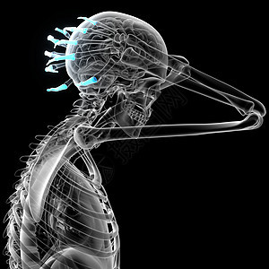 3d 表示人体长颈手的插图手腕手臂指骨肌腱风湿病手指骨骼方阵背景图片