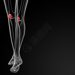 骨板骨肌腱x光药品解剖学伤害蓝色手术控制压力列表图片