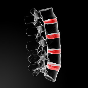 间脊椎圆盘骨干涡流关节封锁尾骨骨骼腰椎自然药品脊柱图片