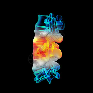 人有脊骨躯干蓝色疼痛背痛骨骼生物学男人脊椎身体肋骨图片