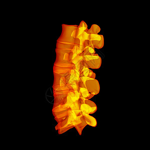 人有脊骨疼痛背痛科学蓝色躯干男人脊椎骨骼黑色x光图片