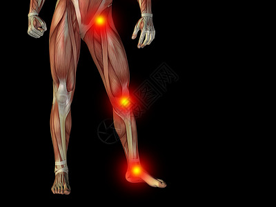 概念上人类身体对黑色的解剖疼痛疾病风湿病软骨列表胫骨解剖学膝盖痛苦韧带大腿图片