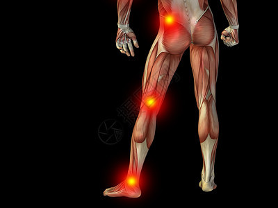 概念上人类身体对黑色的解剖疼痛疾病腓骨风湿病大腿膝盖症状解剖学列表软骨男人图片