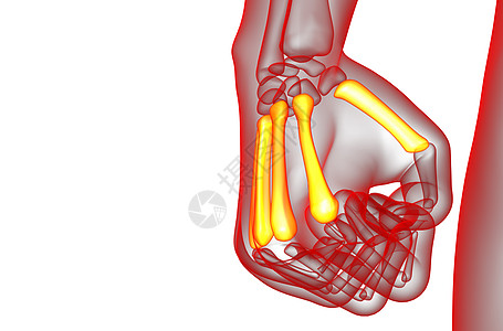 3d 表示对骨骼的医学说明方阵垃圾肌腱指骨手腕掌骨手指风湿病图片