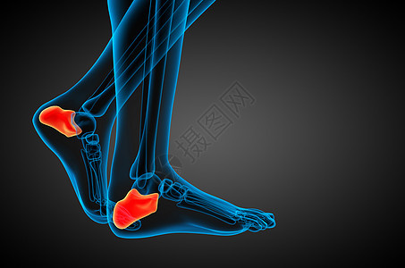 3d 进行医学实验 以解剖加州的骨骼痛苦风湿跟骨创伤痛风病人医疗骨科背景图片