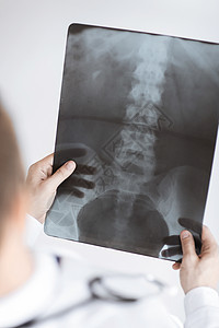 持有X射线或伦琴图像的医生卫生创伤射线电影照相臀部放射科解剖学测试病人图片
