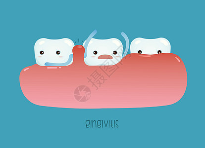 牙科病媒吉比炎图片
