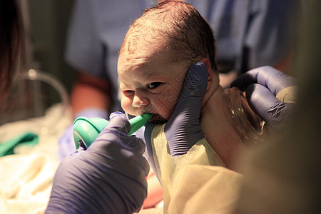 刚出生的女婴科学保健紧迫感婴儿救援情况病人治疗外科分娩图片