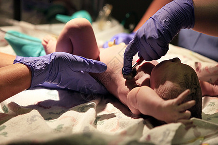 刚出生的女婴保健女儿女性技术手术药品分娩诊所科学切口图片