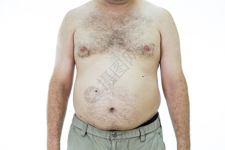 有胖肚子的男人肥胖身体成人腰部饮食白色重量男性图片