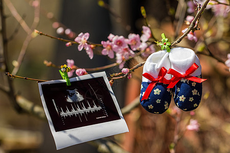 婴儿拖鞋和超声波图像挂在闪光树枝上图片