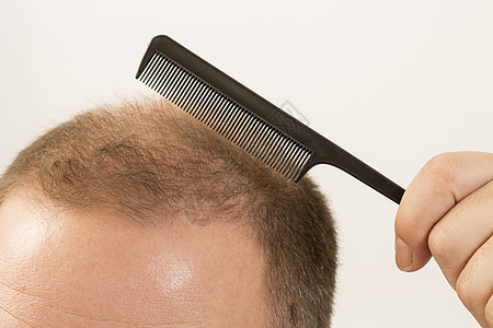 成年男子用手把梳子抓在秃头头上胡须头发保健成人脱发药品活力皮肤男人棕色图片