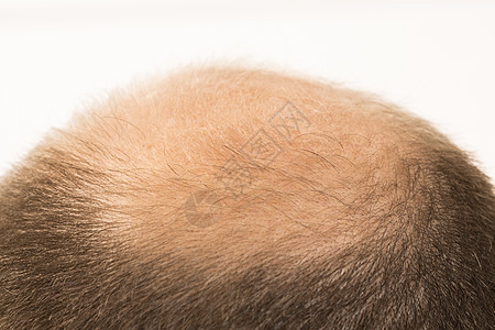 过早秃秃 男人 40岁 白底发型秃顶剪裁胡须卫生成人脱发棕色钙质损失图片