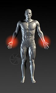 伤 伤肌肉男性疾病理疗疼痛x射线运动解剖学诊断医院图片