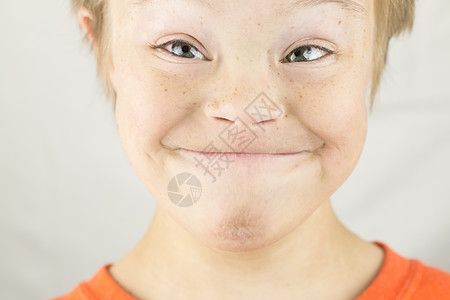 唐氏综合症的面孔好奇心金发挑战鼻子男生微笑生活残障乐趣人士图片