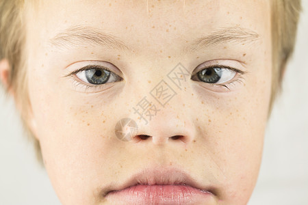 唐氏综合症的面孔学习童年快乐金发嘴唇青年男生残障乐趣喜悦图片