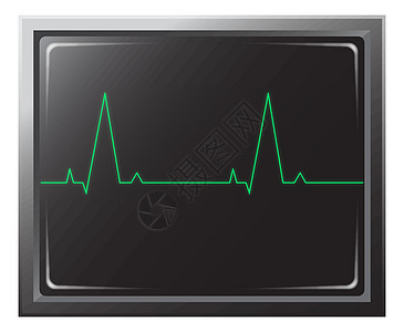 心脏病监测器空白白色医院插图医生屏幕医疗脉冲绿色监视器图片