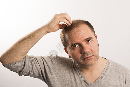 Alopecia 人毛发脱落皮肤头发梳子胡须损失男人疾病护理活力发型背景图片
