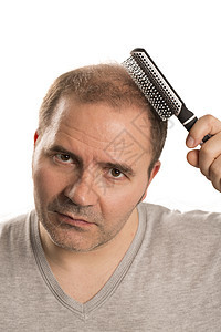 Alopecia 人毛发脱落护理胡须男人活力秃顶剪裁疾病皮肤脱发发型图片