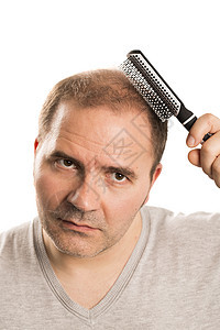 Alopecia 人毛发脱落胡须皮肤头皮梳子头发男人发型剪裁男性脱发图片