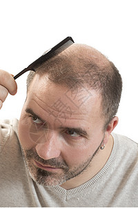 Alopecia 人毛发脱落男性胡须治疗头发梳子疾病活力护理男人皮肤背景图片