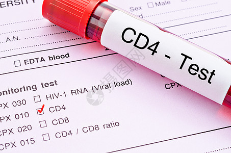 CD4细胞测试图片