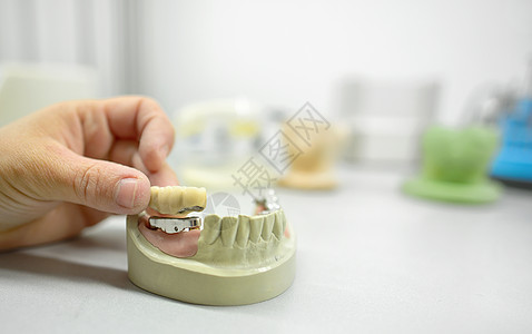 牙科化验室牙科技术技师图片