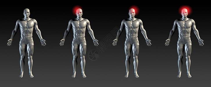 头受伤解剖学疼痛偏头痛扭伤理疗卫生辉光诊断疾病肌肉图片