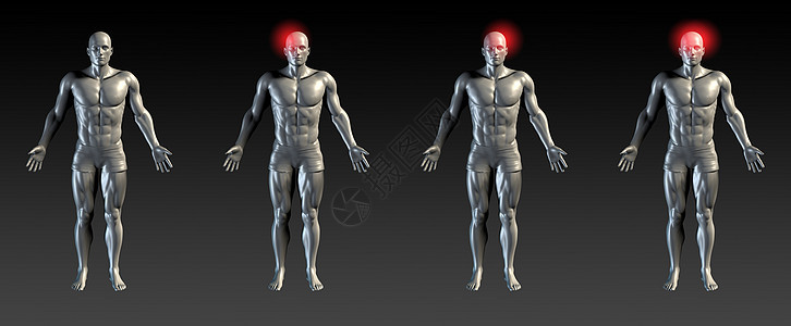 头受伤解剖学疼痛偏头痛扭伤理疗卫生辉光诊断疾病肌肉图片