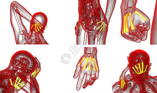 3d 提供代形骨骼医学插图3d手指渲染指骨掌骨肌腱垃圾风湿病方阵手腕背景图片