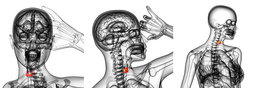 3d 甲状腺图解胸部腹部脖子渲染男人器官解剖学3d背景图片