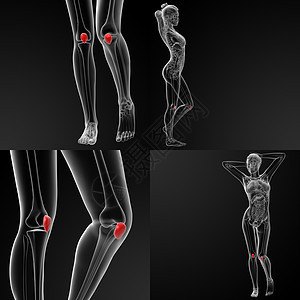 3D 显示骨骼的立体插图韧带运动3d软骨肌腱腓骨护膝手术股骨伤害图片