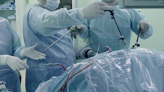腹部的拉帕罗斯外科手术程序诊所手套乐器内窥镜护士医生操作保健专家图片