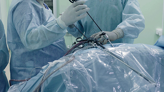 腹部的拉帕罗斯外科手术工作服工具专家病人医院操作乐器护士诊所疾病图片