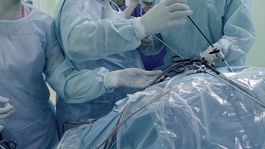 腹部的拉帕罗斯外科手术程序内窥镜乐器卫生蓝色疾病腹腔镜手套医生医院图片