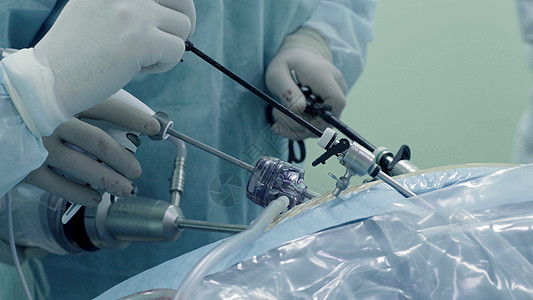 腹部的拉帕罗斯外科手术程序药品房间乐器实施病人身体保健蓝色腹腔镜图片