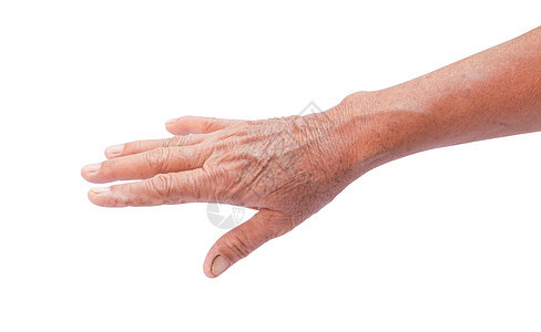 缠在老年妇女的手皮上 健康与美观概念戒指退休男人家庭身体皮肤祖父母女士白色祖母图片