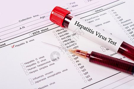 世界肝炎日概念病人世界科学测试实验室肝炎疾病微生物学血液学管子图片