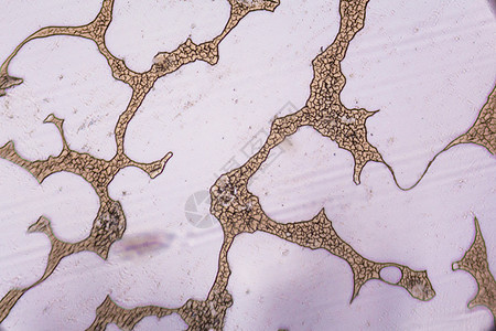 显微镜下凝固的血细胞感染插图染色体死亡疫苗生物鞭毛解剖学药品微生物图片