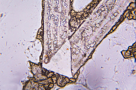 显微镜下凝固的血细胞药品生物生物学解剖学染色体健康细菌微生物科学疾病图片