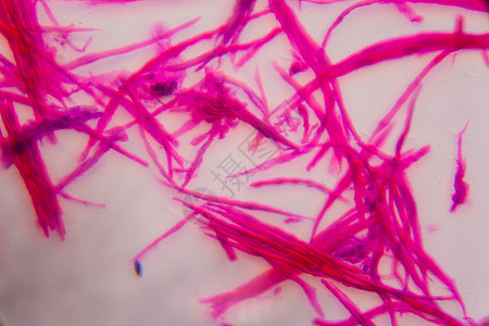 平滑肌在显微镜下分离抽象粉红林辐射解剖学松紧带疾病组织学插图艺术科学紫色生物学图片